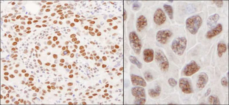 Immunohistochemistry (Formalin/PFA-fixed paraffin-embedded sections) - Anti-hnRNP U/p120 antibody (AB264141)