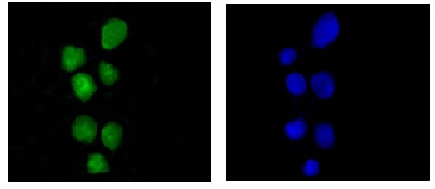 Immunocytochemistry/ Immunofluorescence - Anti-hnRNP U/p120 antibody [EPR12278(2)(B)] (AB180952)