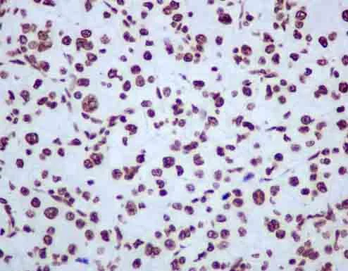 Immunohistochemistry (Formalin/PFA-fixed paraffin-embedded sections) - Anti-hnRNP U/p120 antibody [EPR12278(2)(B)] - BSA and Azide free (AB250283)