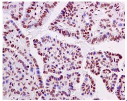 Immunohistochemistry (Formalin/PFA-fixed paraffin-embedded sections) - Anti-hnRNP U/p120 antibody [EPR12279] (AB172608), expandable thumbnail