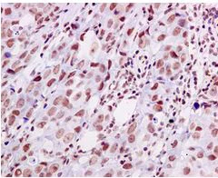 Immunohistochemistry (Formalin/PFA-fixed paraffin-embedded sections) - Anti-hnRNP U/p120 antibody [EPR12279] (AB172608)