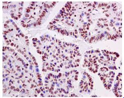 Immunohistochemistry (Formalin/PFA-fixed paraffin-embedded sections) - Anti-hnRNP U/p120 antibody [EPR12279] - BSA and Azide free (AB249705)