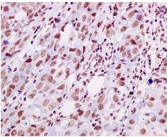 Immunohistochemistry (Formalin/PFA-fixed paraffin-embedded sections) - Anti-hnRNP U/p120 antibody [EPR12279] - BSA and Azide free (AB249705), expandable thumbnail