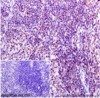 Immunohistochemistry (Formalin/PFA-fixed paraffin-embedded sections) - Anti-HNRNPA0 antibody [EP16085] (AB197023)