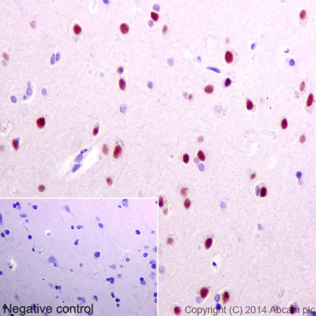 Immunohistochemistry (Formalin/PFA-fixed paraffin-embedded sections) - Anti-HNRNPA0 antibody [EP16085] (AB197023)