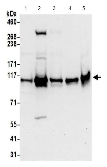 Western blot - Anti-HNRNPUL2 antibody (AB195338)