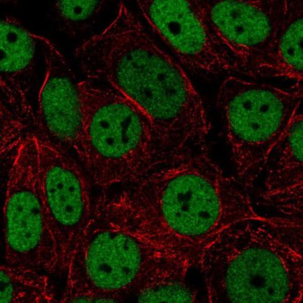 Immunocytochemistry/ Immunofluorescence - Anti-HNRNPUL2 antibody (AB220849), expandable thumbnail