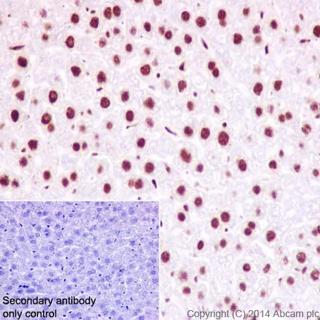 Immunohistochemistry (Formalin/PFA-fixed paraffin-embedded sections) - Anti-HNRPAB antibody [EPR16944] (AB199724)