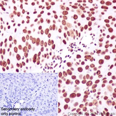 Immunohistochemistry (Formalin/PFA-fixed paraffin-embedded sections) - Anti-HNRPAB antibody [EPR16944] (AB199724)