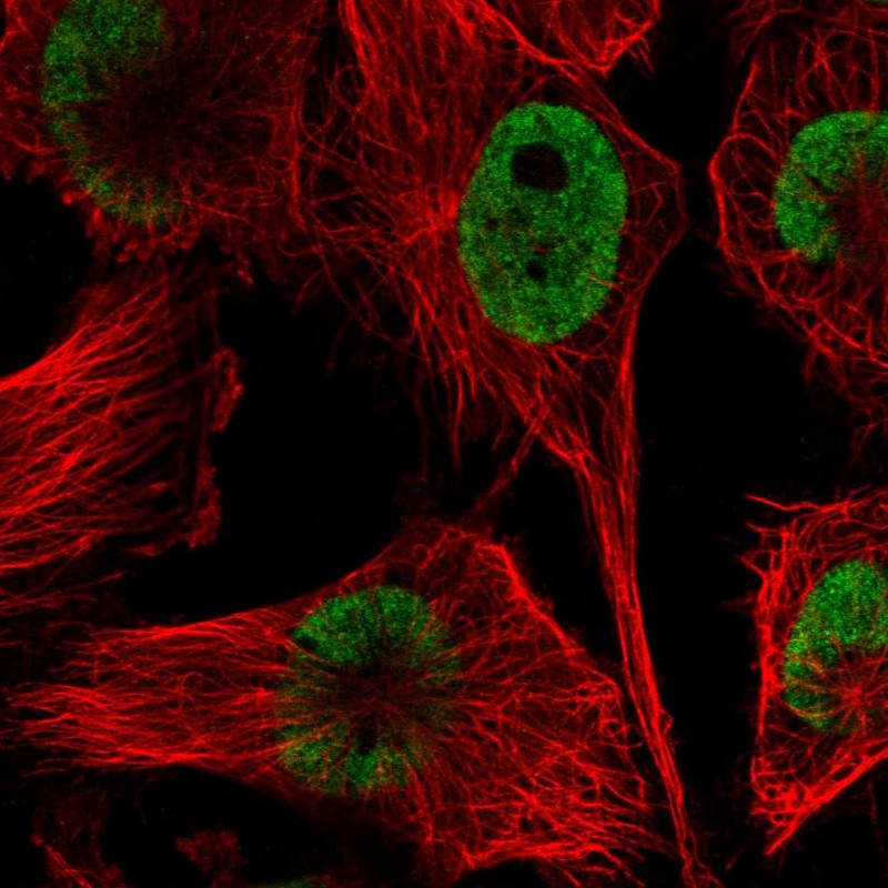 Immunocytochemistry/ Immunofluorescence - Anti-HNRPDL antibody (AB272661)