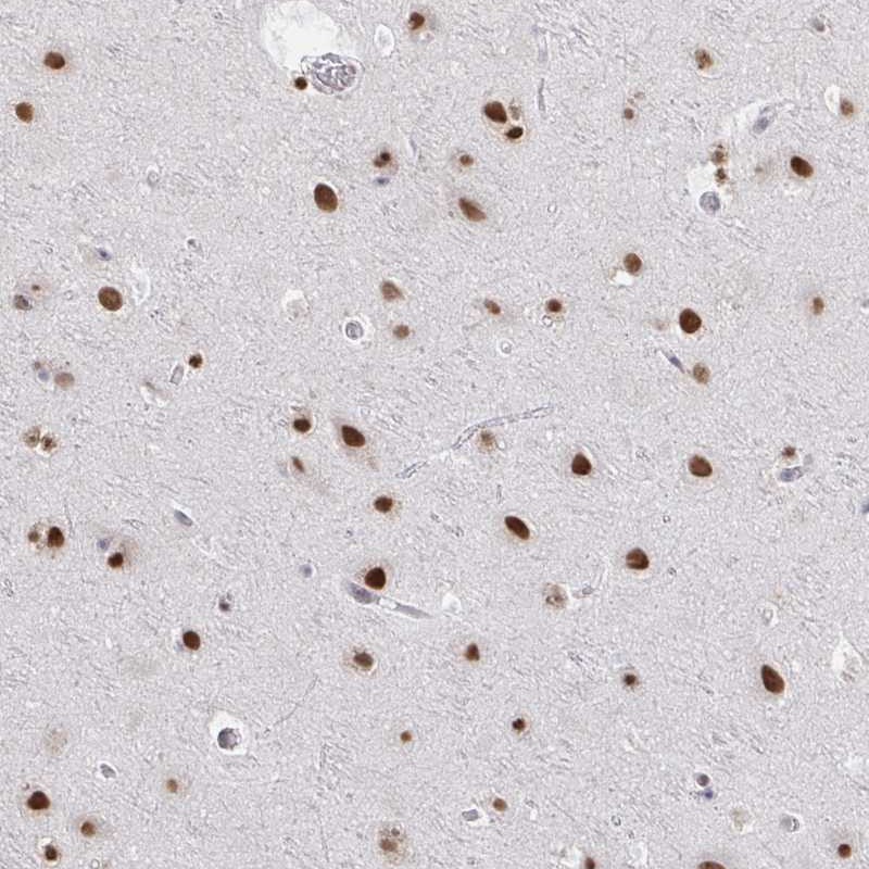 Immunohistochemistry (Formalin/PFA-fixed paraffin-embedded sections) - Anti-HNRPDL antibody (AB272661)