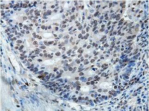 Immunohistochemistry (Formalin/PFA-fixed paraffin-embedded sections) - Anti-HNRPH2/HNRNPH2 antibody (AB157498), expandable thumbnail