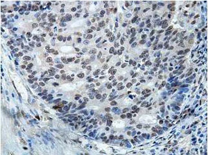 Immunohistochemistry (Formalin/PFA-fixed paraffin-embedded sections) - Anti-HNRPH2/HNRNPH2 antibody (AB157498)