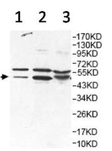 Western blot - Anti-HNRPH2/HNRNPH2 antibody (AB157498)
