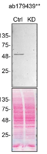 Western blot - Anti-HNRPH2/HNRNPH2 antibody [EPR12170(B)] (AB179439)