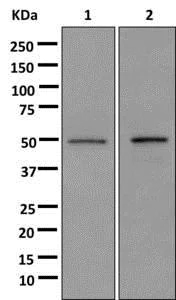 Western blot - Anti-HNRPH2/HNRNPH2 antibody [EPR12170(B)] - BSA and Azide free (AB250086)