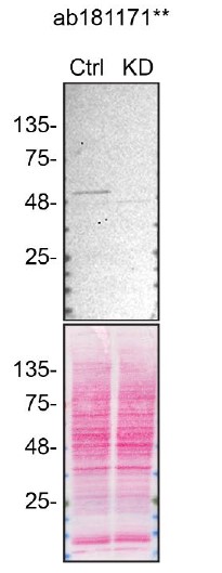 Anti-HNRPH2/HNRNPH2 antibody [EPR12171]