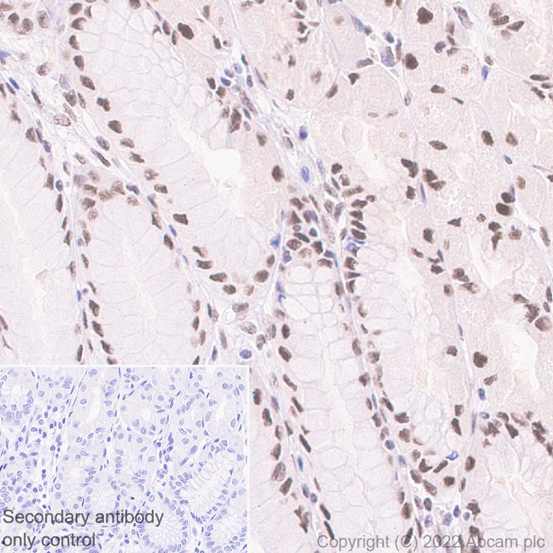 Immunohistochemistry (Formalin/PFA-fixed paraffin-embedded sections) - Anti-HNRPH2/HNRNPH2 antibody [EPR12171] - BSA and Azide free (ab250397), expandable thumbnail