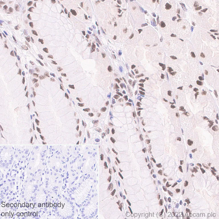 Immunohistochemistry (Formalin/PFA-fixed paraffin-embedded sections) - Anti-HNRPH2/HNRNPH2 antibody [EPR12171] - BSA and Azide free (AB250397)