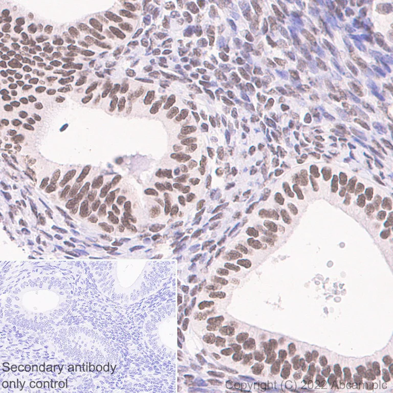 Immunohistochemistry (Formalin/PFA-fixed paraffin-embedded sections) - Anti-HNRPH2/HNRNPH2 antibody [EPR12171] - BSA and Azide free (AB250397)