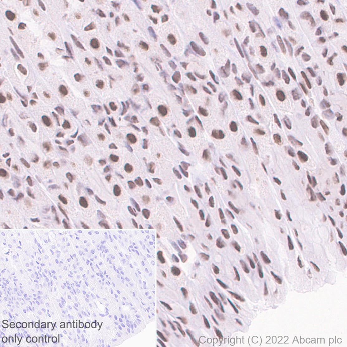 Immunohistochemistry (Formalin/PFA-fixed paraffin-embedded sections) - Anti-HNRPH2/HNRNPH2 antibody [EPR12171] - BSA and Azide free (AB250397), expandable thumbnail