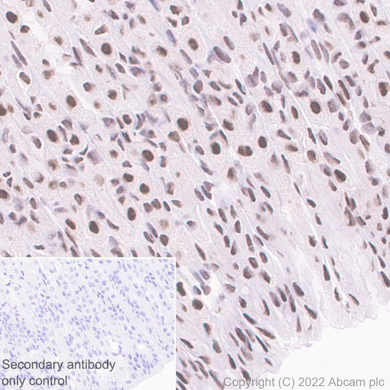 Immunohistochemistry (Formalin/PFA-fixed paraffin-embedded sections) - Anti-HNRPH2/HNRNPH2 antibody [EPR12171] - BSA and Azide free (AB250397)