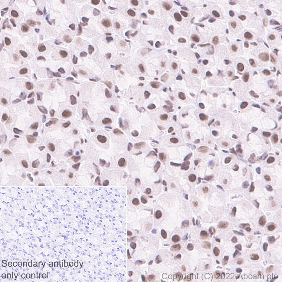 Immunohistochemistry (Formalin/PFA-fixed paraffin-embedded sections) - Anti-HNRPH2/HNRNPH2 antibody [EPR12171] - BSA and Azide free (AB250397), expandable thumbnail