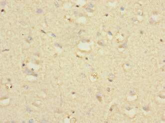 Immunohistochemistry (Formalin/PFA-fixed paraffin-embedded sections) - Anti-HNT antibody (AB230351), expandable thumbnail