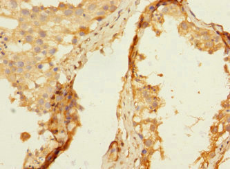 Immunohistochemistry (Formalin/PFA-fixed paraffin-embedded sections) - Anti-HNT antibody (AB230351), expandable thumbnail