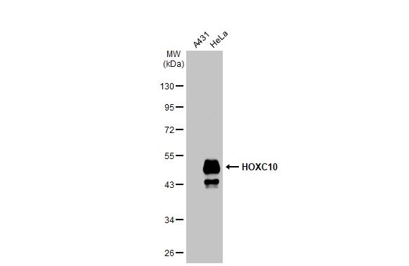 Western blot - Anti-Homeobox C10 antibody [HL1234] (AB308350), expandable thumbnail