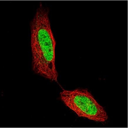 Immunocytochemistry/ Immunofluorescence - Anti-Homeobox protein cut-like 1 antibody [CL5275] (AB242194), expandable thumbnail
