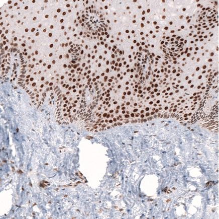 Immunohistochemistry (Formalin/PFA-fixed paraffin-embedded sections) - Anti-Homeobox protein cut-like 1 antibody [CL5275] (AB242194), expandable thumbnail