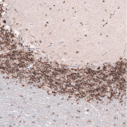 Immunohistochemistry (Formalin/PFA-fixed paraffin-embedded sections) - Anti-Homeobox protein cut-like 1 antibody [CL5275] (AB242194), expandable thumbnail