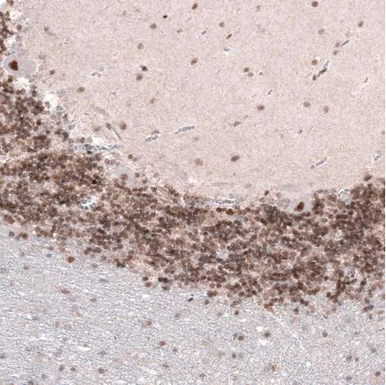 Immunohistochemistry (Formalin/PFA-fixed paraffin-embedded sections) - Anti-Homeobox protein cut-like 1 antibody [CL5275] (AB242194)