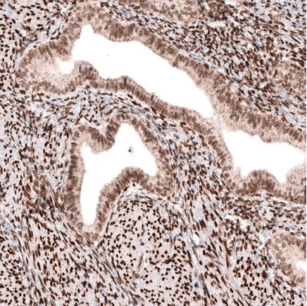 Immunohistochemistry (Formalin/PFA-fixed paraffin-embedded sections) - Anti-Homeobox protein cut-like 1 antibody [CL5275] (AB242194), expandable thumbnail