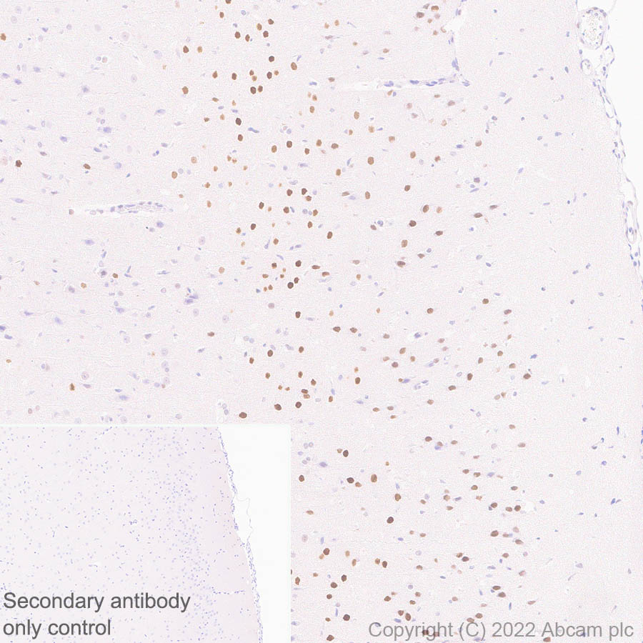 Immunohistochemistry (Formalin/PFA-fixed paraffin-embedded sections) - Anti-Homeobox protein cut-like 1 antibody [EPR26508-67] (ab307821), expandable thumbnail