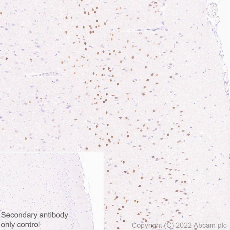 Immunohistochemistry (Formalin/PFA-fixed paraffin-embedded sections) - Anti-Homeobox protein cut-like 1 antibody [EPR26508-67] (AB307821)