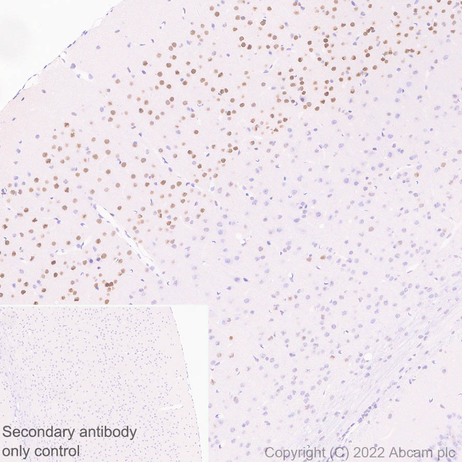 Immunohistochemistry (Formalin/PFA-fixed paraffin-embedded sections) - Anti-Homeobox protein cut-like 1 antibody [EPR26508-67] - BSA and Azide free (AB307822), expandable thumbnail