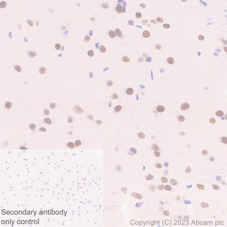 Immunohistochemistry (Formalin/PFA-fixed paraffin-embedded sections) - Anti-Homeobox protein cut-like 2 antibody [EPR26509-79] (AB315796)
