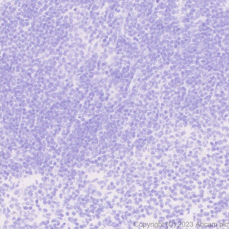 Immunohistochemistry (Formalin/PFA-fixed paraffin-embedded sections) - Anti-Homeobox protein cut-like 2 antibody [EPR26509-79] (AB315796)