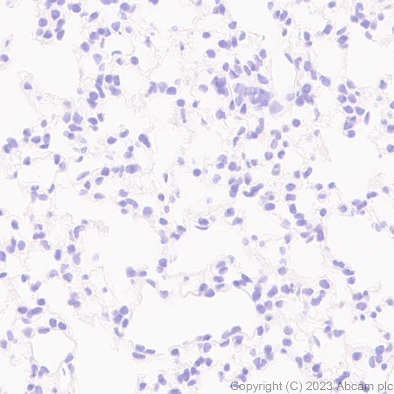 Immunohistochemistry (Formalin/PFA-fixed paraffin-embedded sections) - Anti-Homeobox protein cut-like 2 antibody [EPR26509-79] (AB315796)