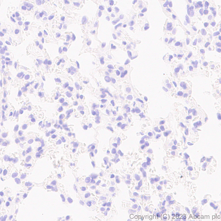Immunohistochemistry (Formalin/PFA-fixed paraffin-embedded sections) - Anti-Homeobox protein cut-like 2 antibody [EPR26509-79] (AB315796)