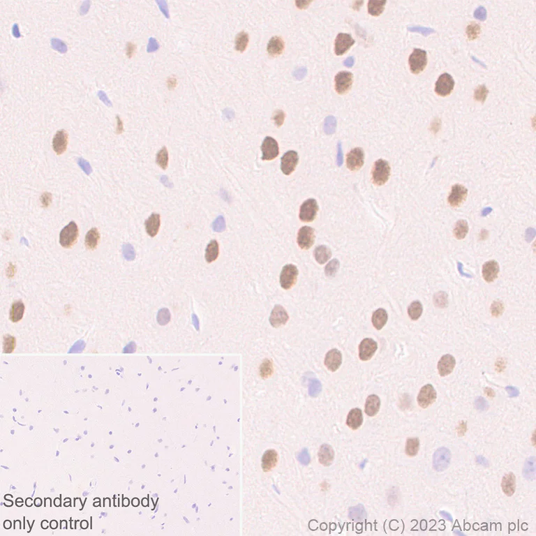 Immunohistochemistry (Formalin/PFA-fixed paraffin-embedded sections) - Anti-Homeobox protein cut-like 2 antibody [EPR26509-79] - BSA and Azide free (AB315797)