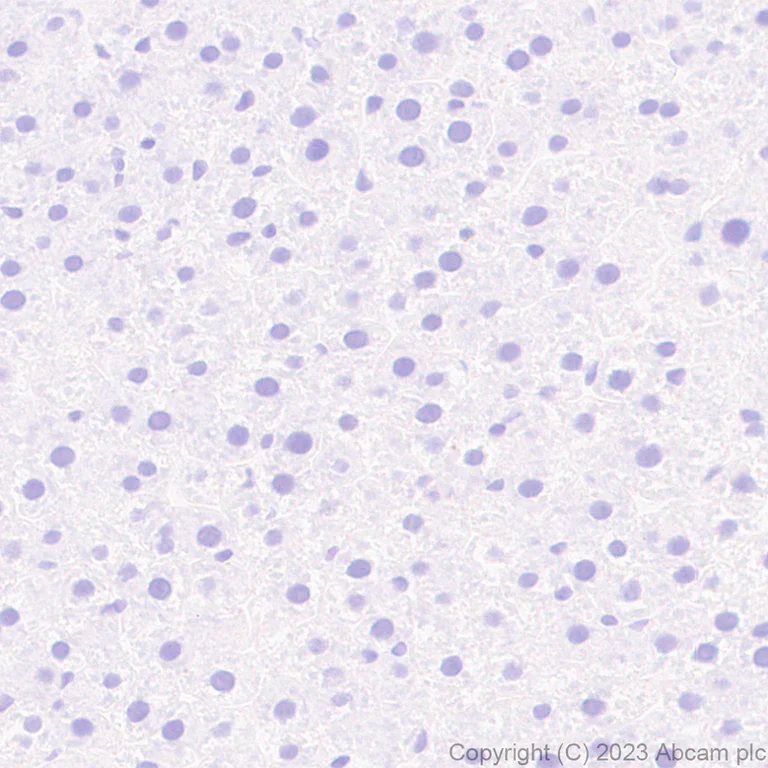 Immunohistochemistry (Formalin/PFA-fixed paraffin-embedded sections) - Anti-Homeobox protein cut-like 2 antibody [EPR26509-79] - BSA and Azide free (AB315797)