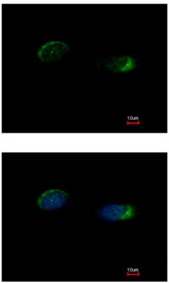 Immunocytochemistry/ Immunofluorescence - Anti-Homer1 antibody (AB211415), expandable thumbnail