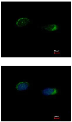 Immunocytochemistry/ Immunofluorescence - Anti-Homer1 antibody (AB211415)