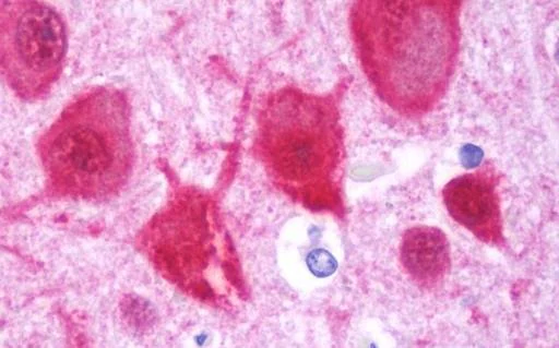 Immunohistochemistry (Formalin/PFA-fixed paraffin-embedded sections) - Anti-Homer1 antibody (AB211415)