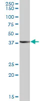 Western blot - Anti-Homer1 antibody (AB88827)