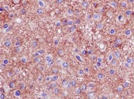 Immunohistochemistry (Formalin/PFA-fixed paraffin-embedded sections) - Anti-Homer1 antibody [EPR15309] (AB184955)