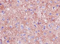 Immunohistochemistry (Formalin/PFA-fixed paraffin-embedded sections) - Anti-Homer1 antibody [EPR15309] (AB184955)